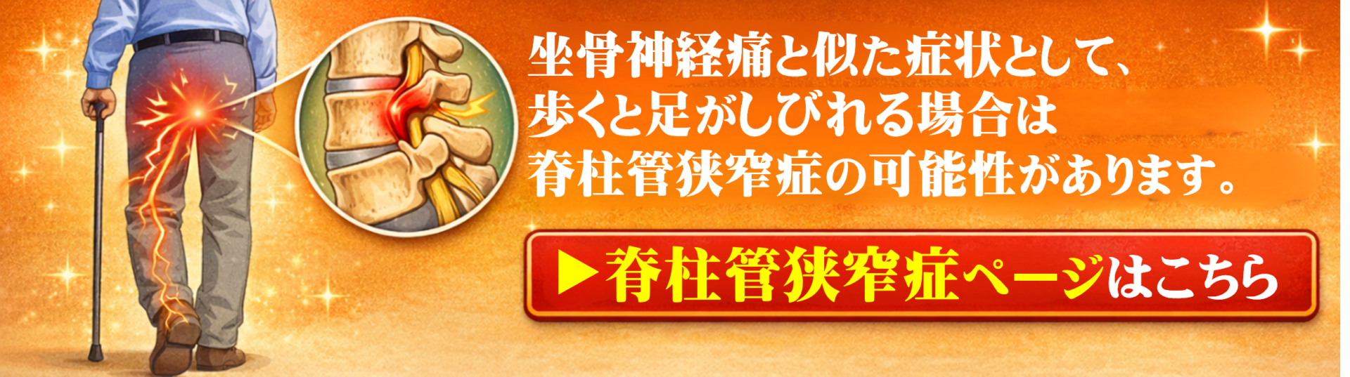坐骨神経痛と似た症状として歩くと足がしびれる場合は脊柱管狭窄症の可能性があります。脊柱管狭窄症ページはこちら