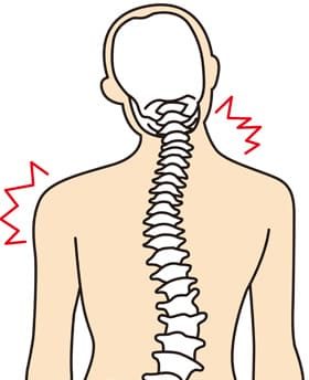背骨のゆがみ