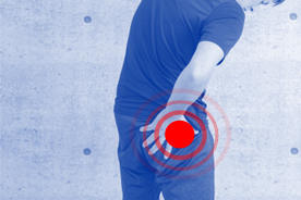 坐骨神経痛でおしりが痛い